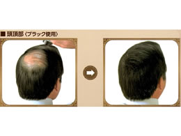 ルアン スーパーミリオンヘアー 30g ブラック | Forestway【通販